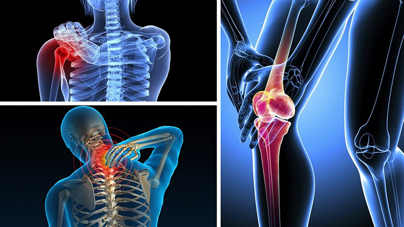 Đau nhức xương khớp sau sinh – Nguyên nhân, dấu hiệu & điều trị tại MSC Hà NộiTin tức xã hội