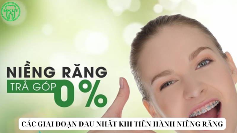 Những điều cần lưu ý khi tiến hành niềng răng trả gópTin tức xã hội